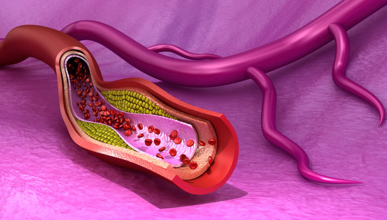 Hipercholesterolemia a błędy dietetyczne u osób  w starszym wieku