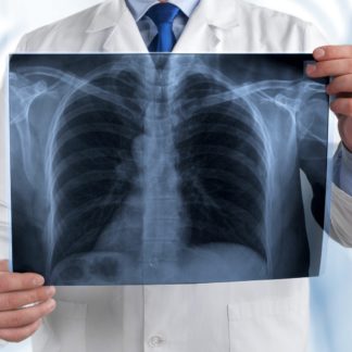 Zapalenie płuc u osób starszych