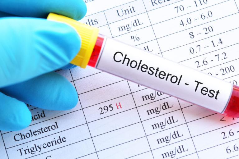 Podwyższony cholesterol a stres