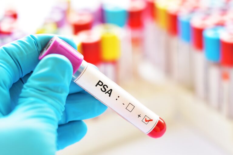 Pytamy o raka prostaty – wywiad z urologiem dr n. med. Przemysławem Dudkiem