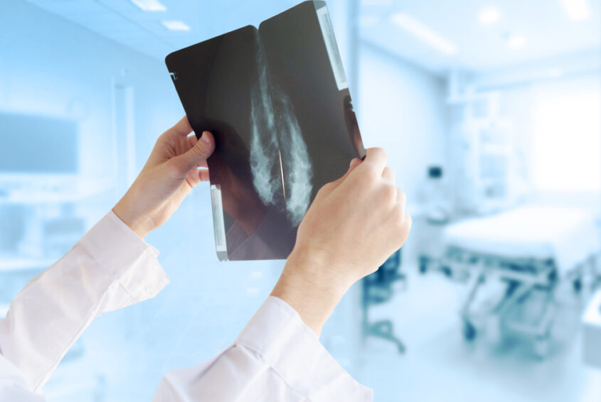 nowotwory ginekologiczne