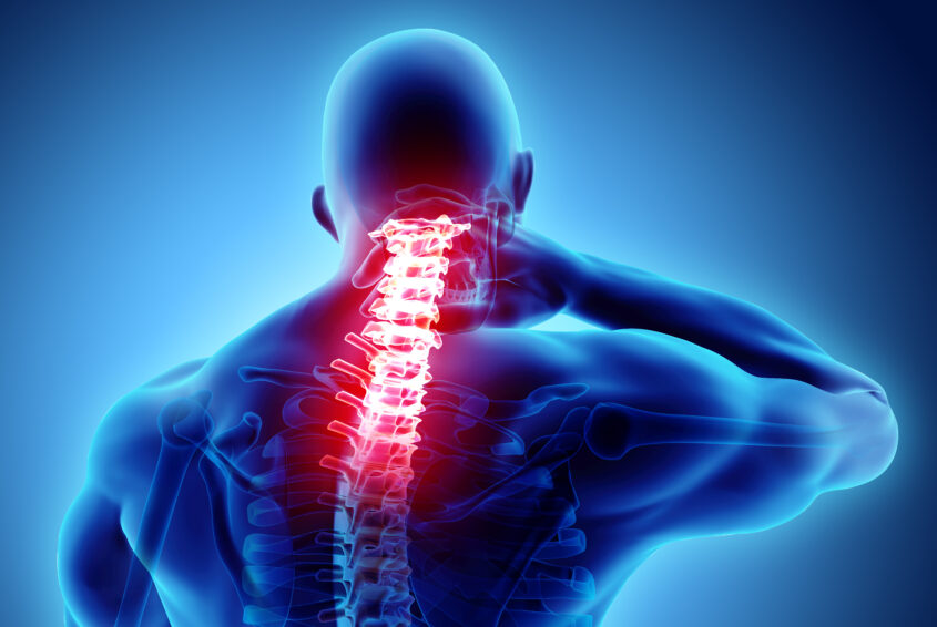 3D illustration, neck painful - cervical spine skeleton x-ray, m Ćwiczenia na ból karku