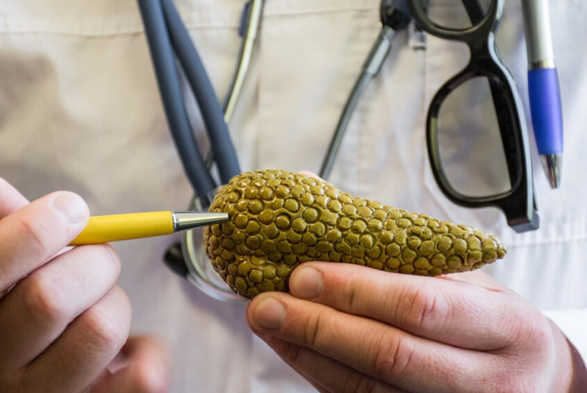 Rak trzustki_01 rak trzustki objawy